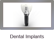 Dental Implants - Dental Care Glebe